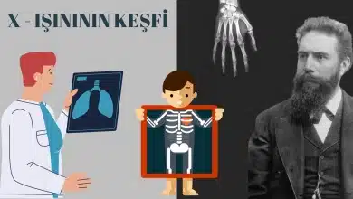 İçimizi Dışarı Çıkaran Aleti Keşfeden Bilim İnsanı: Wilhelm Röntgen Röntgen