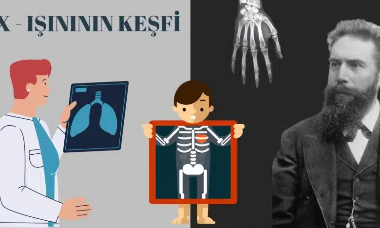 İçimizi Dışarı Çıkaran Aleti Keşfeden Bilim İnsanı: Wilhelm Röntgen Röntgen