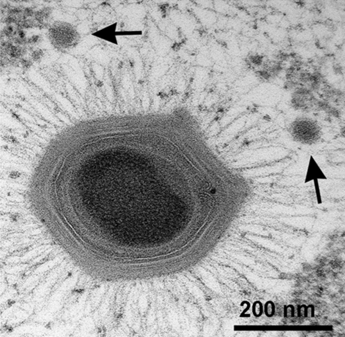 Virüslerin Gizemi: Canlılık ve Cansızlık Arasındaki İnce Çizgi virus2